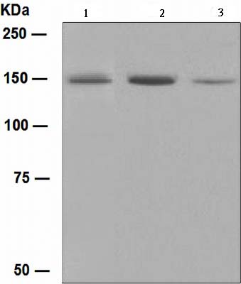 Western blot - Anti-Phospholipase C gamma 1/PLC-gamma-1 antibody [EPR5358] (AB109501), expandable thumbnail