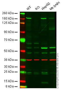 Western blot - Anti-Phospholipase C gamma 1/PLC-gamma-1 antibody [EPR5358] (AB109501)