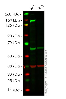 Western blot - Anti-Phospholipase C gamma 1/PLC-gamma-1 antibody [EPR5358] - BSA and Azide free (AB247882)