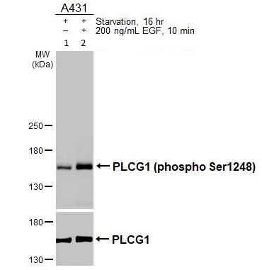 Western blot - Anti-Phospholipase C gamma 1/PLC-gamma-1 (phospho S1248) antibody - C-terminal (AB226926)