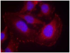 Immunocytochemistry/ Immunofluorescence - Anti-Phospholipase C gamma 1/PLC-gamma-1 (phospho Y771) antibody (AB131455)