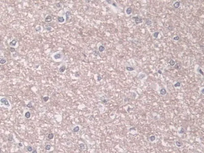 Immunohistochemistry (Formalin/PFA-fixed paraffin-embedded sections) - Anti-Phospholipase D antibody (AB233238)