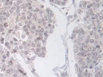 Immunohistochemistry (Formalin/PFA-fixed paraffin-embedded sections) - Anti-Phospholipase D antibody (AB233238)
