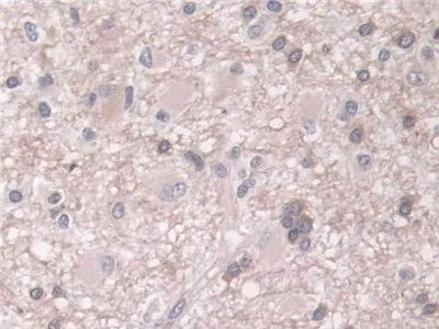 Immunohistochemistry (Formalin/PFA-fixed paraffin-embedded sections) - Anti-Phospholipase D antibody (AB233238)