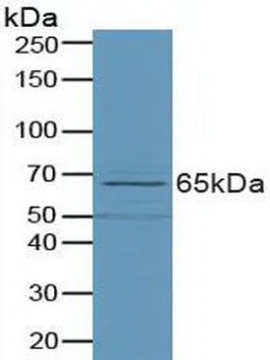 Western blot - Anti-Phospholipase D antibody (AB233238)