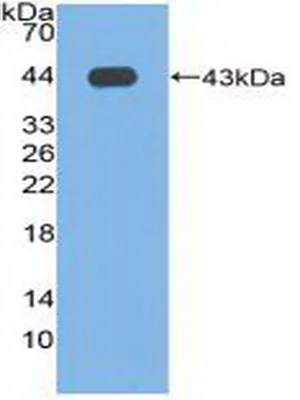 Western blot - Anti-Phospholipase D antibody (AB233238)