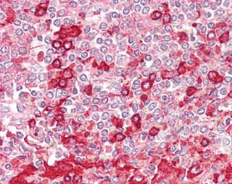 Immunohistochemistry (Formalin/PFA-fixed paraffin-embedded sections) - Anti-Phospholipase D1 antibody (AB189191), expandable thumbnail