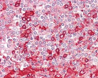 Immunohistochemistry (Formalin/PFA-fixed paraffin-embedded sections) - Anti-Phospholipase D1 antibody (AB189191)
