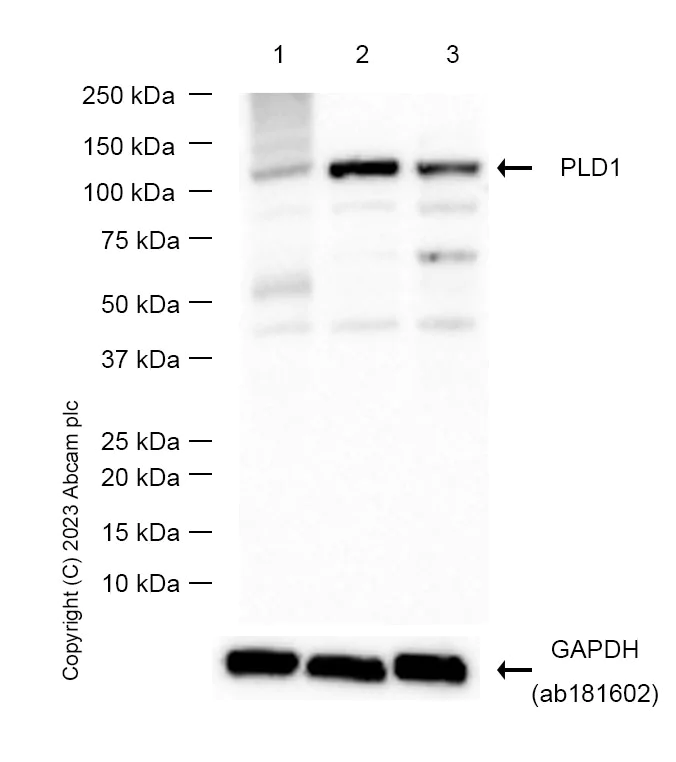 Western blot - Anti-Phospholipase D1 antibody [EP1506Y] - BSA and Azide free (AB235997)