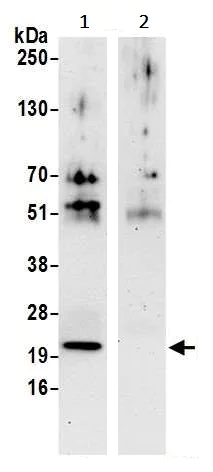 Immunoprecipitation - Anti-Phosphomevalonate kinase antibody (AB242095)
