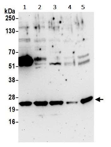 Western blot - Anti-Phosphomevalonate kinase antibody (AB242095)