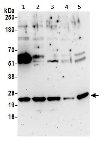 Western blot - Anti-Phosphomevalonate kinase antibody (AB242095)