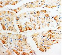 Immunohistochemistry (Formalin/PFA-fixed paraffin-embedded sections) - Anti-Phosphomevalonate kinase antibody (AB65806)