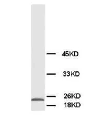 Western blot - Anti-Phosphomevalonate kinase antibody (AB65806)