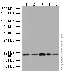 Western blot - Anti-Phosphomevalonate kinase antibody [EPR15029] - BSA and Azide free (AB251290), expandable thumbnail