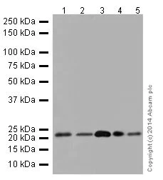 Western blot - Anti-Phosphomevalonate kinase antibody [EPR15029] - BSA and Azide free (AB251290)
