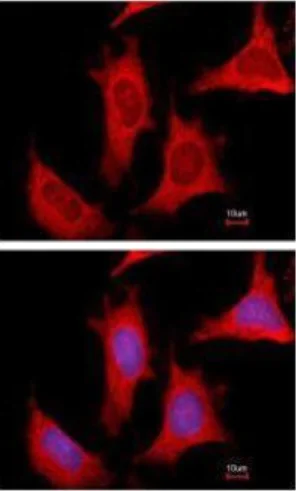 Immunocytochemistry/ Immunofluorescence - Anti-Phosphoribosyl pyrophosphate amidotransferase antibody (AB125864)