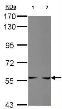 Western blot - Anti-Phosphoribosyl pyrophosphate amidotransferase antibody (AB125864)