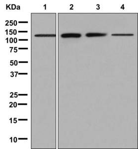 Western blot - Anti-Phosphorylase B/PHKB antibody [EPR9035(2)] (AB181360), expandable thumbnail