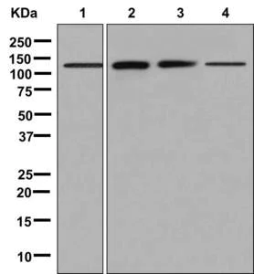 Western blot - Anti-Phosphorylase B/PHKB antibody [EPR9035(2)] - BSA and Azide free (AB250488)