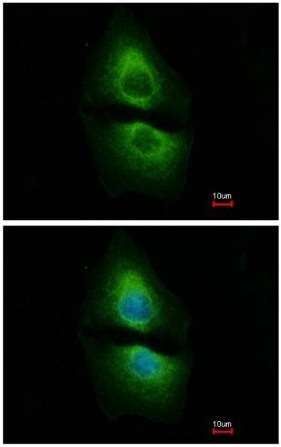 Immunocytochemistry/ Immunofluorescence - Anti-Phosphoserine Aminotransferase antibody (AB154055), expandable thumbnail