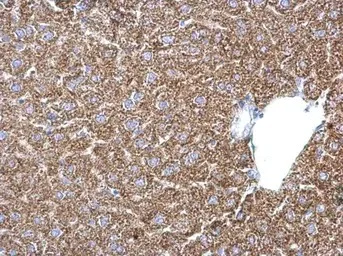 Immunohistochemistry (Formalin/PFA-fixed paraffin-embedded sections) - Anti-Phosphoserine Aminotransferase antibody (AB154055)