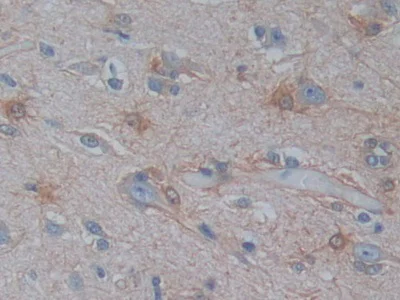 Immunohistochemistry (Formalin/PFA-fixed paraffin-embedded sections) - Anti-Phosphoserine Aminotransferase antibody (AB232944)