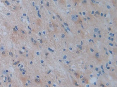 Immunohistochemistry (Formalin/PFA-fixed paraffin-embedded sections) - Anti-Phosphoserine Aminotransferase antibody (AB232944)