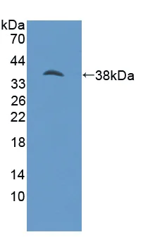 Western blot - Anti-Phosphoserine Aminotransferase antibody (AB232944)