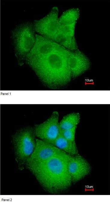 Immunocytochemistry/ Immunofluorescence - Anti-Phosphoserine Aminotransferase antibody (AB96136)