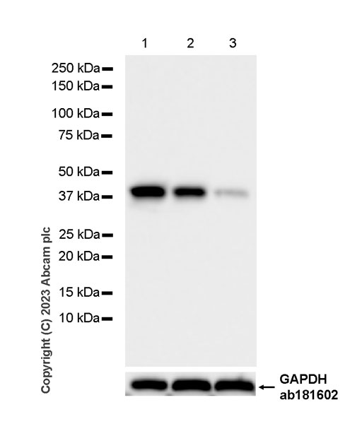 Western blot - Anti-Phosphoserine Aminotransferase antibody [EPR26994-48] (AB308512), expandable thumbnail