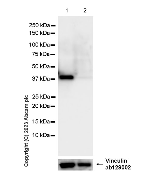 Western blot - Anti-Phosphoserine Aminotransferase antibody [EPR26994-48] (AB308512), expandable thumbnail