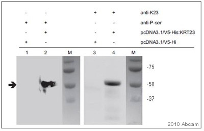Western blot - Anti-Phosphoserine antibody (AB9332), expandable thumbnail