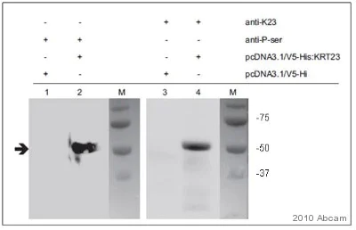 Western blot - Anti-Phosphoserine antibody (AB9332)