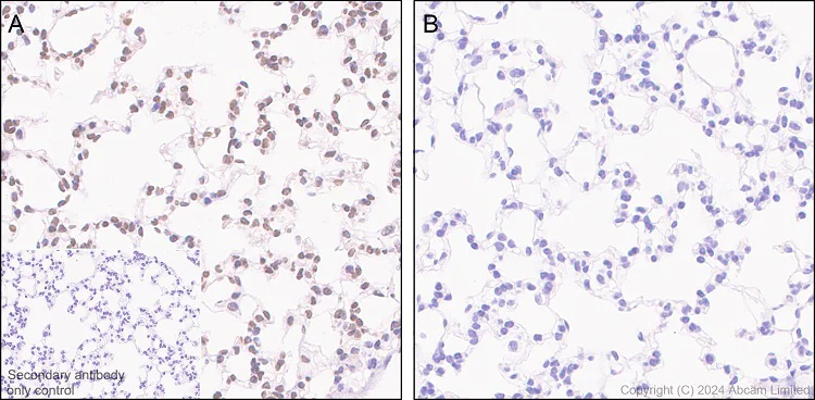 Immunohistochemistry (Formalin/PFA-fixed paraffin-embedded sections) - Anti-Phosphoserine antibody [EPR28666-51] (AB322140)
