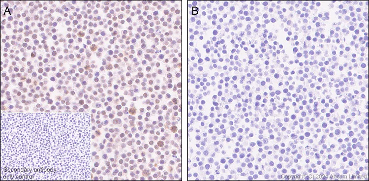 Immunohistochemistry (Formalin/PFA-fixed paraffin-embedded sections) - Anti-Phosphoserine antibody [EPR28666-51] (AB322140)