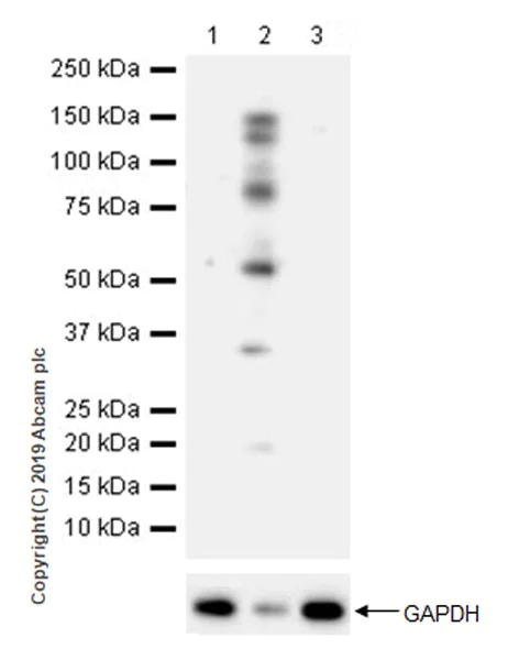 Western blot - Anti-Phosphothreonine antibody [EPR22006-23] (AB218195)