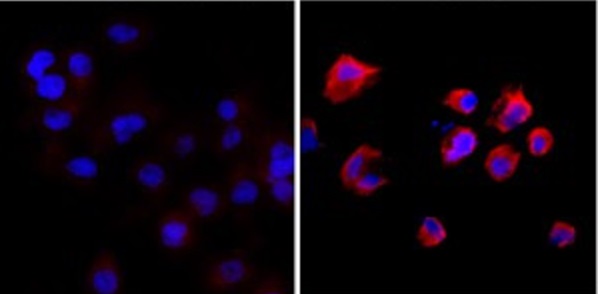 Immunocytochemistry/ Immunofluorescence - Anti-Phosphothreonine antibody [RM102] (AB238305)