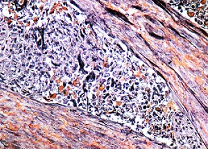 Immunohistochemistry (Formalin/PFA-fixed paraffin-embedded sections) - Phosphotungstic Acid Hematoxylin (PTAH) Stain Kit (Connective Tissue Stain) (AB150683)