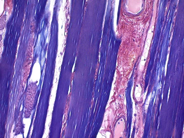 Immunohistochemistry (Formalin/PFA-fixed paraffin-embedded sections) - Phosphotungstic Acid Hematoxylin (PTAH) Stain Kit (Connective Tissue Stain) (AB150683), expandable thumbnail