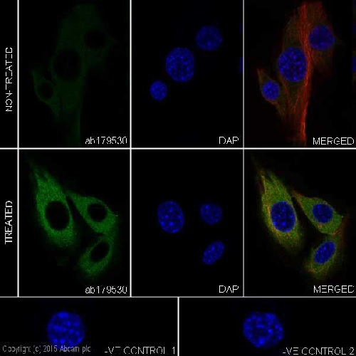 Immunocytochemistry/ Immunofluorescence - Anti-Phosphotyrosine antibody [EPR16871] - BSA and Azide free (AB240219), expandable thumbnail
