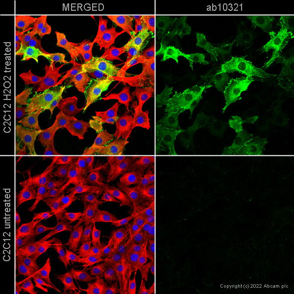 Immunocytochemistry/ Immunofluorescence - Anti-Phosphotyrosine antibody [PY20] (AB10321), expandable thumbnail