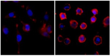 Immunocytochemistry/ Immunofluorescence - Anti-Phosphotyrosine antibody [RM111] (AB190824), expandable thumbnail
