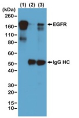 Immunoprecipitation - Anti-Phosphotyrosine antibody [RM111] (AB190824), expandable thumbnail