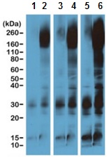 Western blot - Anti-Phosphotyrosine antibody [RM111] (AB190824), expandable thumbnail