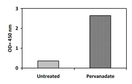Sandwich ELISA - Phosphotyrosine Eph receptor B2 ELISA Kit (AB279783)