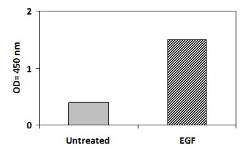 Sandwich ELISA - Phosphotyrosine ErbB2 / HER2 ELISA Kit (AB279788)