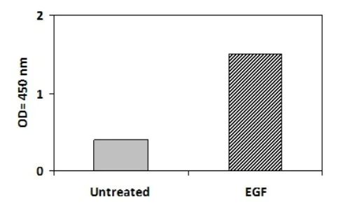 Sandwich ELISA - Phosphotyrosine ErbB2 / HER2 ELISA Kit (AB279788)