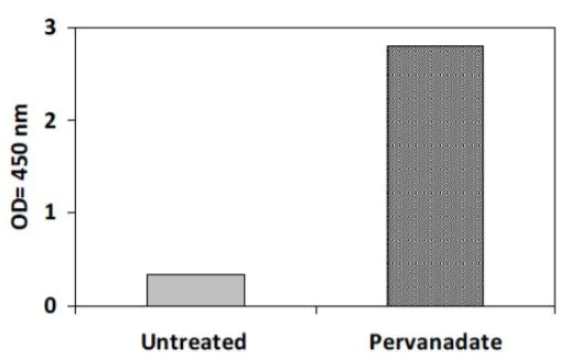 Sandwich ELISA - Phosphotyrosine ROR2 ELISA Kit (AB279909)