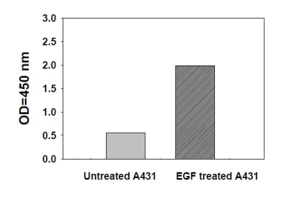 Sandwich ELISA - Phosphotyrosine STAT5 ELISA Kit (AB279945)